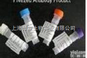 Anti-hHb抗体,小鼠抗人<em>血红蛋白单克隆抗体</em>     现货供应