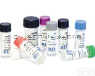 W3A-H-005B  <em>WNT</em>-3a,<em>human</em> W3A-H-005B 人源 <em>WNT</em>-3a 蛋...