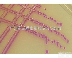 科玛嘉金黄色<em>葡萄球菌</em><em>显色</em><em>培养基</em>