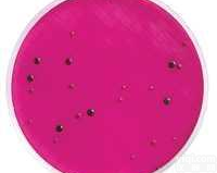 结晶紫中性红<em>胆盐</em><em>琼脂</em>（含<em>葡萄糖</em>和乳糖）