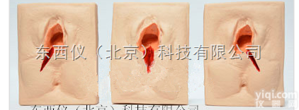 wi1484  wi1484<em>外阴</em><em>切开</em><em>缝合</em>模型