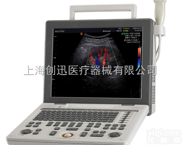 <em>三星</em>麦迪逊便携<em>彩超</em>SONOACE R3**彩色超声诊断仪