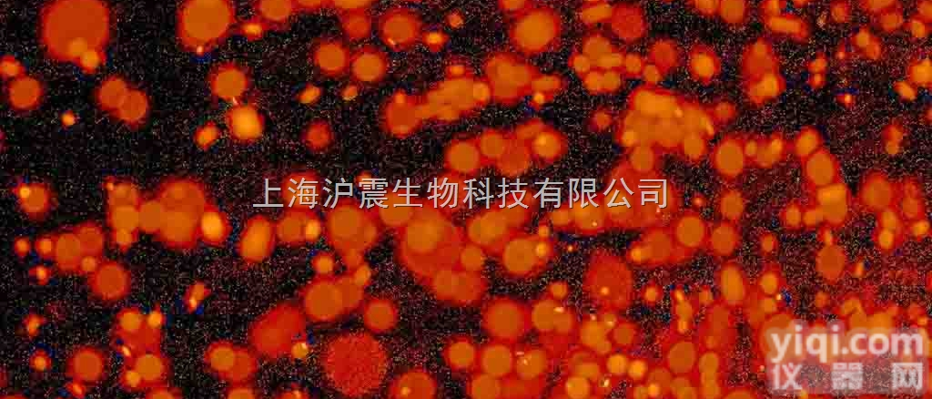 <em>小鼠</em>肾足<em>细胞</em> Mouse <em>podocyte</em><em>细胞</em>