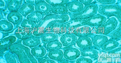 <em>小鼠</em>红<em>白血病</em><em>细胞</em> MEL<em>细胞</em>