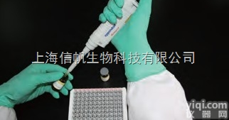 <em>小鼠</em>抗小核糖核蛋白/Sm抗体（snRNP/Sm）ELISA试剂盒 <em>购买</em>...