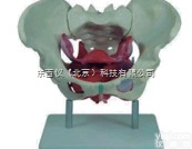 wi700  wi700女性<em>骨盆</em>及<em>盆底</em><em>肌肉</em>模型