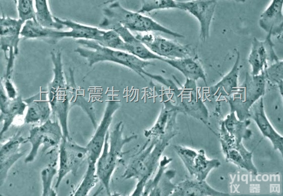 人<em>食管癌</em>细胞 <em>EC871214</em>细胞