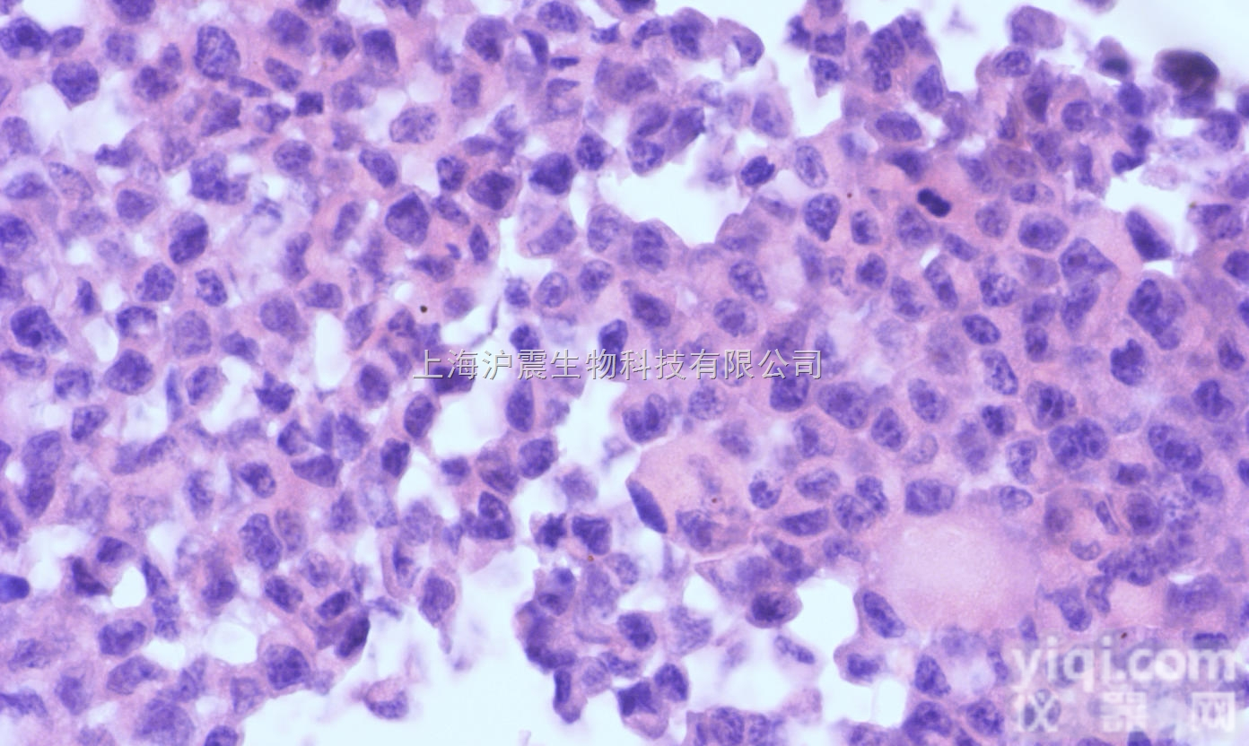 人<em>十二指肠</em><em>腺癌</em><em>细胞</em> HuTu-80<em>细胞</em>