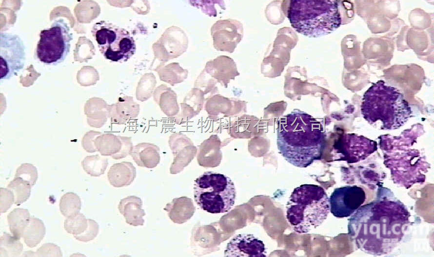 人<em>肾上腺</em><em>腺瘤</em><em>细胞</em> NCI-H205<em>细胞</em>