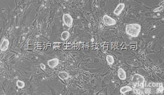 人<em>乳腺</em><em>癌瘤</em>株 MCF-7<em>细胞</em>