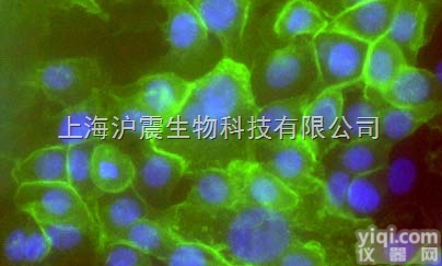 人<em>盲肠</em><em>腺癌</em><em>细胞</em>（未分化）Hce-8693<em>细胞</em>