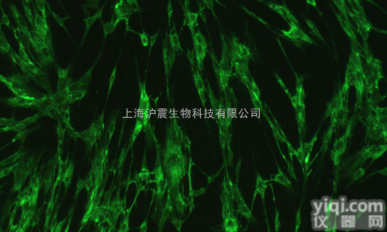 人淋巴<em>细胞</em>与<em>仓鼠</em>肺<em>细胞</em>杂交<em>细胞</em> FD6<em>细胞</em>