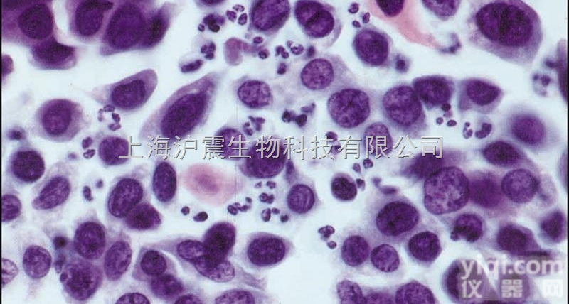 人<em>Burkitt's</em><em>淋巴瘤</em>细胞 <em>Daudi</em>细胞