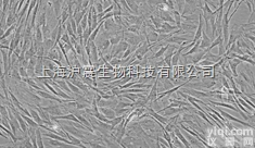 大鼠肝<em>癌细胞</em>（乳腺<em>癌细胞</em>接种到肝脏成瘤） Walker-256细胞