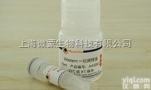 Anti-CRP<em>抗体</em>,鼠抗人C-<em>反应</em><em>蛋白</em>单克隆<em>抗体</em>