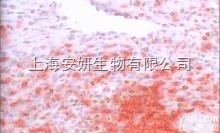 人<em>横纹</em><em>癌细胞</em>，A<em>673</em>