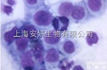 人<em>移行</em>细胞膀胱<em>癌细胞</em>，T-24细胞