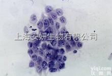 <em>小鼠</em>B<em>细胞</em><em>杂交瘤</em><em>细胞</em>，W6/32<em>细胞</em>