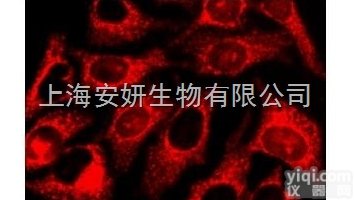 Anti-<em>CYFRA</em>21-1<em>抗体</em>，肿瘤<em>标志物</em><em>CYFRA</em>21-1<em>抗体</em>