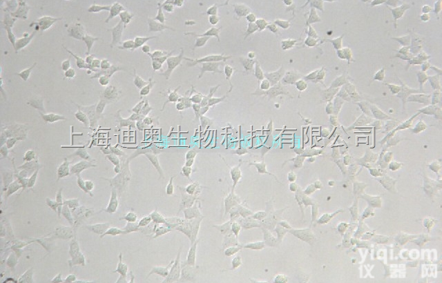 CRL-1730  人脐静脉内皮细胞 （HUVEC） <em>细胞株</em>