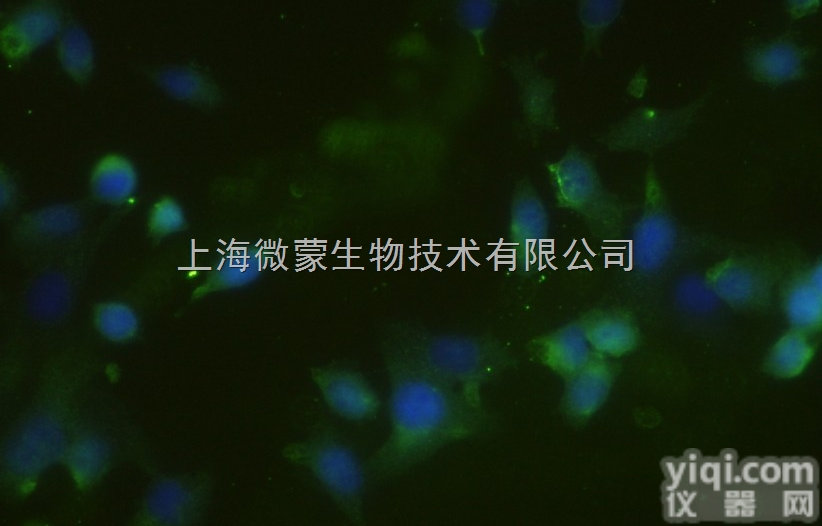 Anti-LAR<em>抗体</em>,<em>受体</em><em>蛋白</em>酪氨酸磷酸酶F<em>抗体</em>