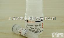 Anti-IGF2AS<em>抗体</em>,IGF2<em>基因</em>的<em>互补</em><em>基因</em>1蛋白<em>抗体</em>