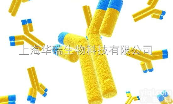 Anti-ENPP5<em>抗体</em>,<em>磷酸酶</em>/磷酸二酯酶家族成员5<em>抗体</em>