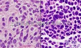 <em></em>C<em></em>a<em></em>l<em></em>u<em></em>-<em></em>6<em></em>�<em></em>�<em></em>�<em></em>�<em></em>�<em></em>�<em></em>,<em>人肺癌细胞</em><em></em>�<em></em>�<em></em>�<em></em>�<em></em>�<em></em>�<em></em>�<em></em>�<em></em>�<em></em>�<em></em>�<em></em>�<em></em>�<em></em>�<em></em>�<em></em>�<em></em>�<em></em>�<em></em>