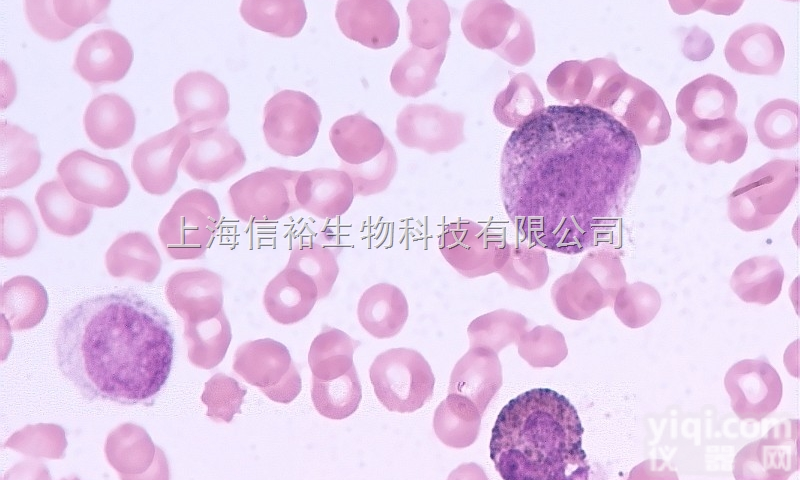 NCI-H292（<em>肺癌</em><em>细胞</em>（<em>淋巴结</em>转移）