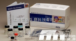 上海<em>生物科</em>研所<em>小鼠</em>可溶性血管内皮生长因子受体（sFLT） ELISA试...