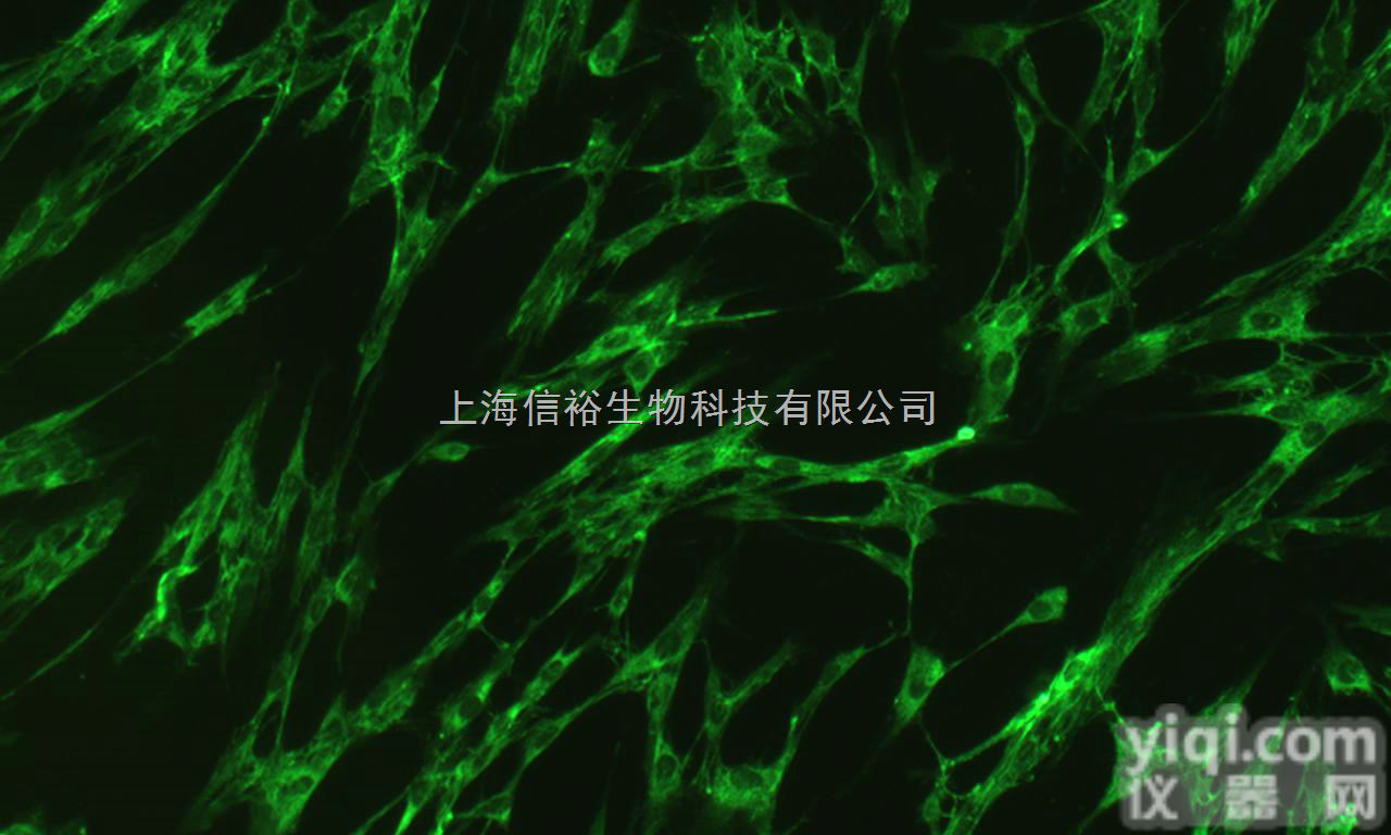 <em>败毒</em>梭菌<em>Clostridium</em> <em>septicum</em>