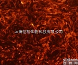 血<em>细胞</em>瘤<em>细胞</em>系 Ramos<em>细胞</em>