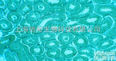 小鼠<em>树突状</em><em>细胞</em><em>肉瘤</em><em>细胞</em>,DCS<em>细胞</em>