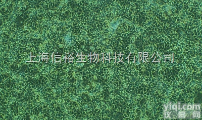 大鼠肝<em>癌细胞</em>（乳腺<em>癌细胞</em>接种到肝脏成瘤） Walker-256细胞