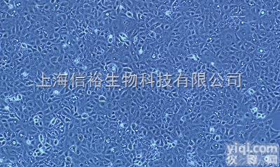 大鼠<em>肝癌</em> R15<em>细胞</em>,