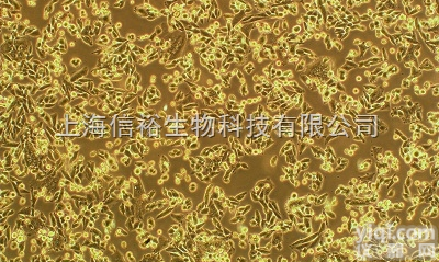 <em>白介素-2转染耐VP16绒癌细胞,JEG-3/VP16-IL-2细胞</em>