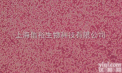 <em>TNFa转染耐VP16绒癌细胞,JEG-3-VP16-TNFa细胞</em>