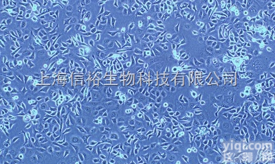 KM<em>小鼠</em>网织<em>细胞</em><em>肉瘤</em>瘤株 LⅡ<em>细胞</em>