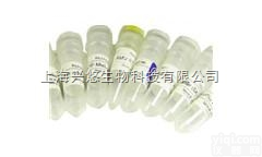 Anti-TP53/FITC<em>荧光</em>素标记<em>抗肿瘤</em>P53<em>抗体</em>IgG