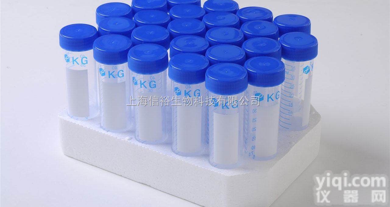 Kyphoscoliosis Peptidase （KY） 抗体