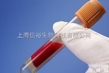 Metal-Regulatory Transcription Fact...