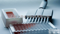 人ELISA<em>试剂盒</em>,人<em>血清素</em>/血清胺（ST）ELISA<em>试剂盒</em>价格