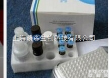 猪<em>弓形</em>虫IgG<em>抗体</em><em>诊断试剂</em>盒