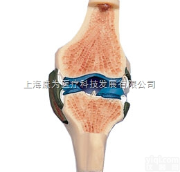 W19006  膝关节切面模型|<em>德国3B人体解剖模型</em>