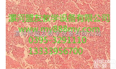 <em>病理切片</em>  <em>病理切片</em>-图为大叶性肺炎