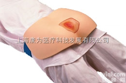 W30506  <em>褥疮</em>ZL护理模拟|<em>德国</em>3B人体解剖模型