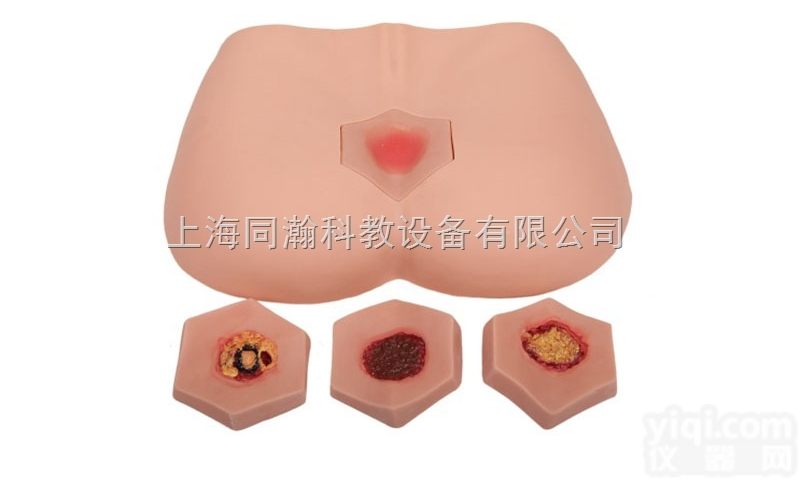 TAH/10B  阶段<em>褥疮</em><em>护理模型</em>护理专业技能训练模型