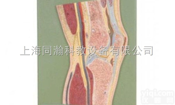 TAH/11206  人体<em>解剖</em>医学<em>模型</em><em>膝关节</em>剖面<em>模型</em>