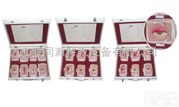 TAH/17110  人体解剖医学<em>模型</em>常见<em>眼病</em><em>模型</em>