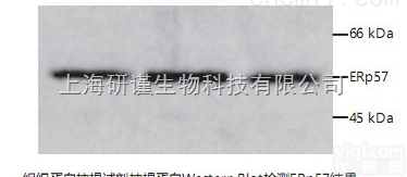 100次  组织蛋白抽提试剂<em>Tissue</em> Protein <em>Extraction</em> R...